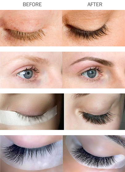 Eyebrow & Eyelashes Treatments